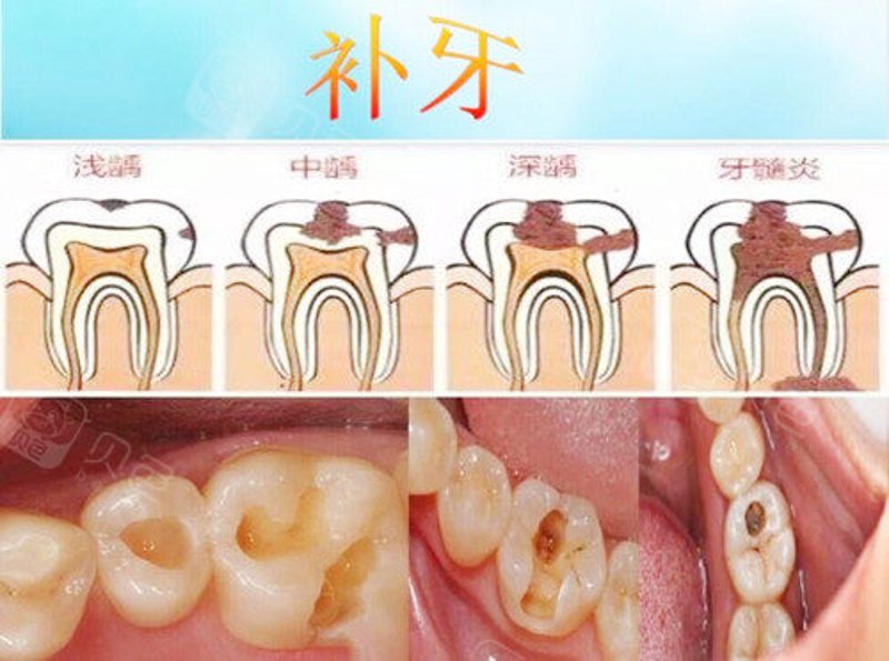 牙齿矫正:从微笑到自信的蜕变